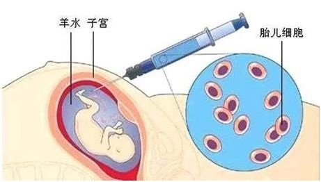無創胎兒親子鑒定、羊水親子鑒定、毛發親子鑒定分別怎么做？