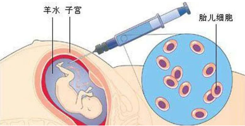 孕期做胎兒親子鑒定合適嗎？孕期有哪些胎兒親子鑒定方法？