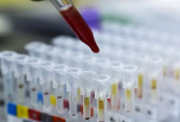 DNA親子鑒定會出錯嗎？根據樣本檢測位點出錯的概率是多少呢？